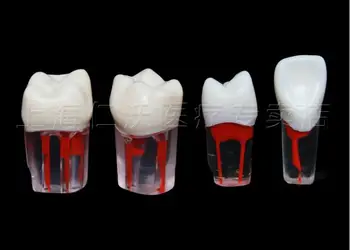 Egzamino praktikos preparato skylę su pulpos ertmę celiuliozės dalelės Visą nagų modeliavimo danties modelis Izoliuotas dantų atviros pulpos