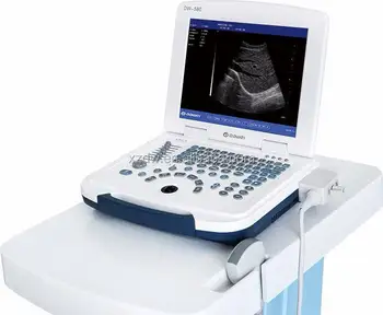Karšto pardavimo Nešiojamų Diagnostikos echoskopiškai & echoskopija ultragarsu scanner & nešiojamas kišeninis nešiojamas ultragarsinis tyrimas